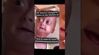 Elo ja sabe as cores #baby #youtubeshorts #progeria #trending #lindas